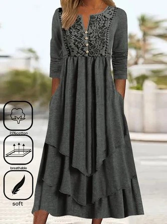 Lace Casual Loose Dress 1 Lace Casual Loose Dress